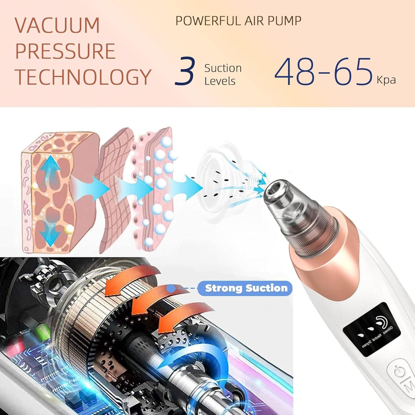 4‑in‑1 Blackhead Removal Suction Machine – Cell Operated