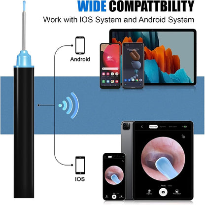 Smart Wireless Ear Cleaner with HD Camera & LED Light – Ear Wax Removal Cleaning Tool